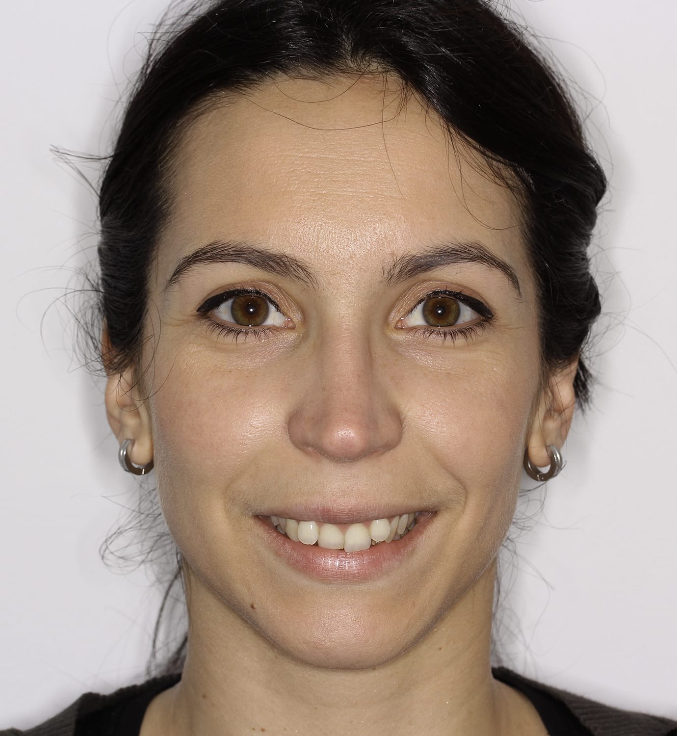 fotografía de antes