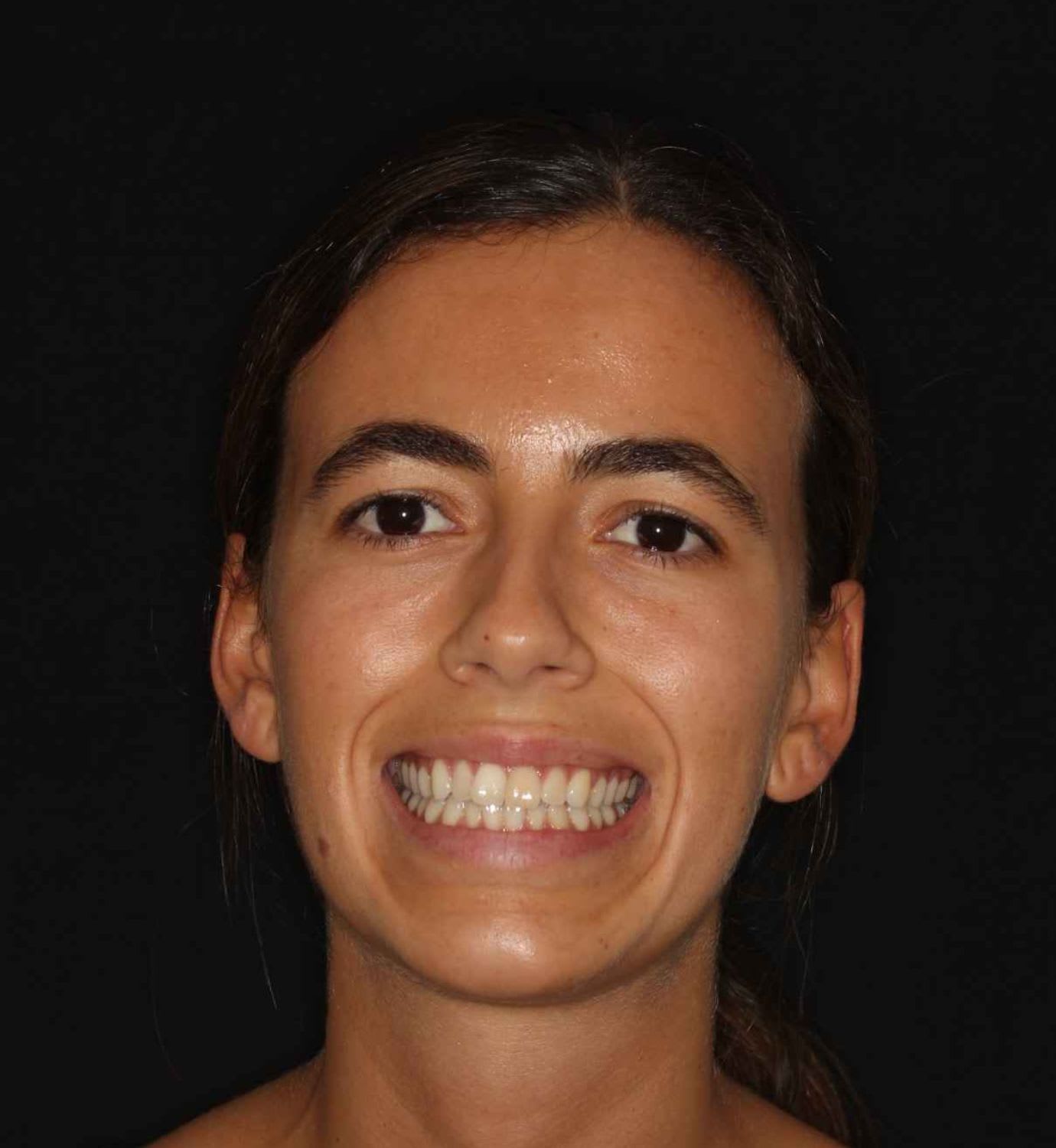 fotografía de antes