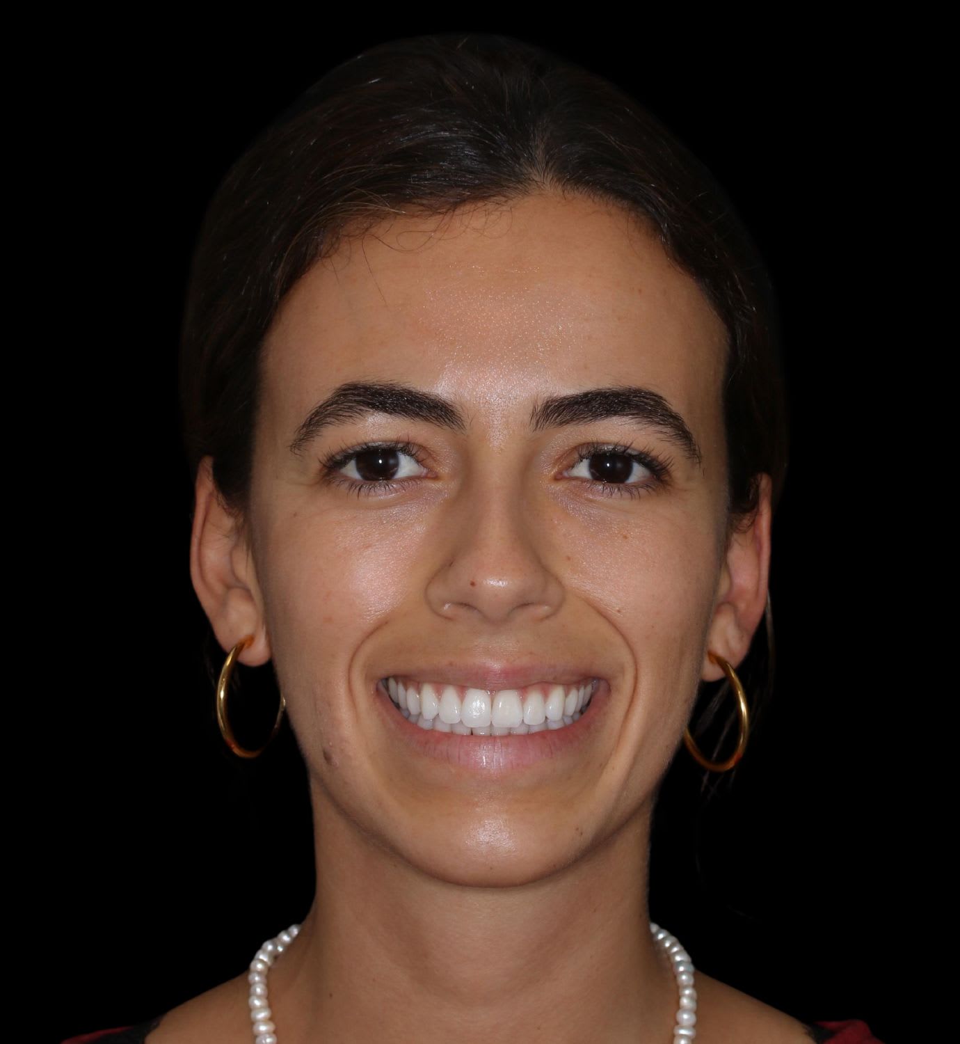 fotografía de después