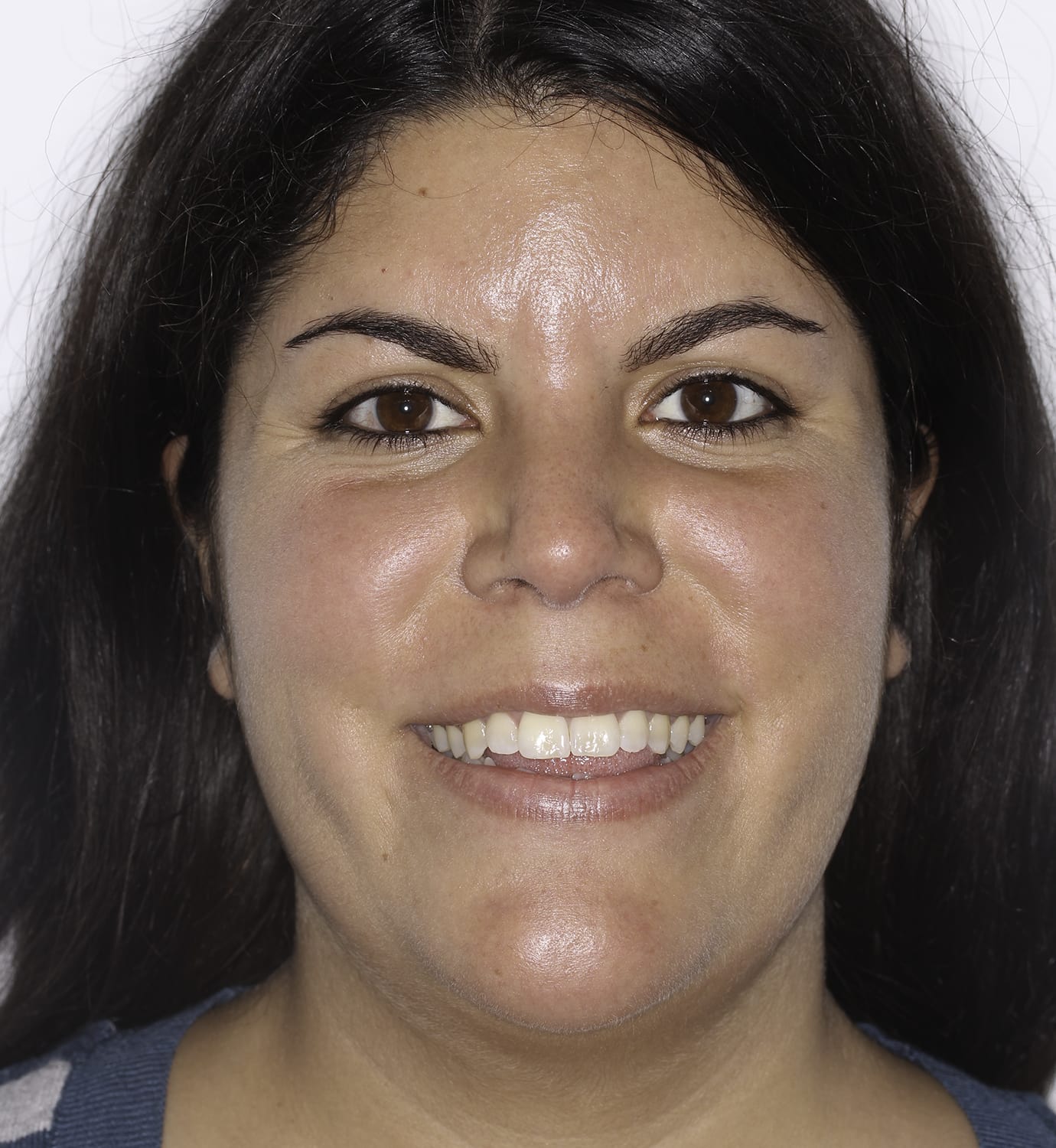 fotografía de antes