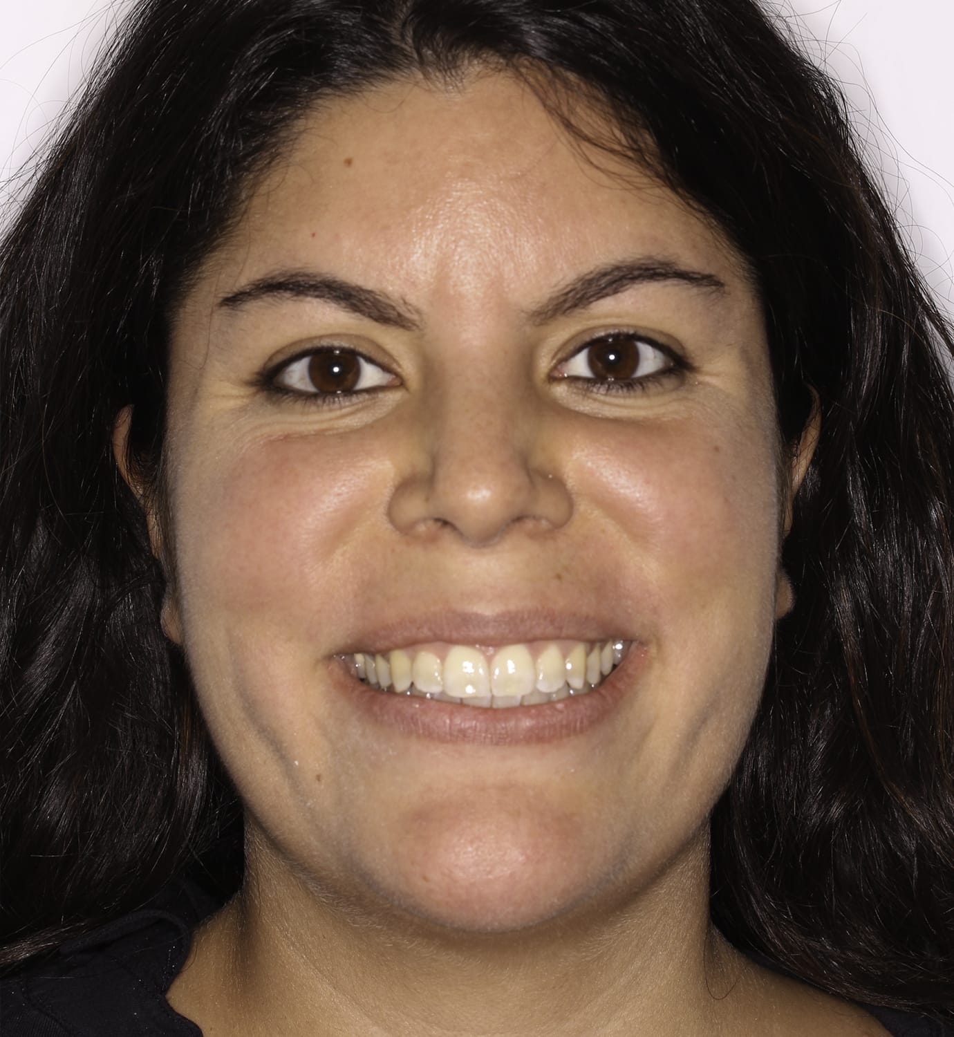 fotografía de después