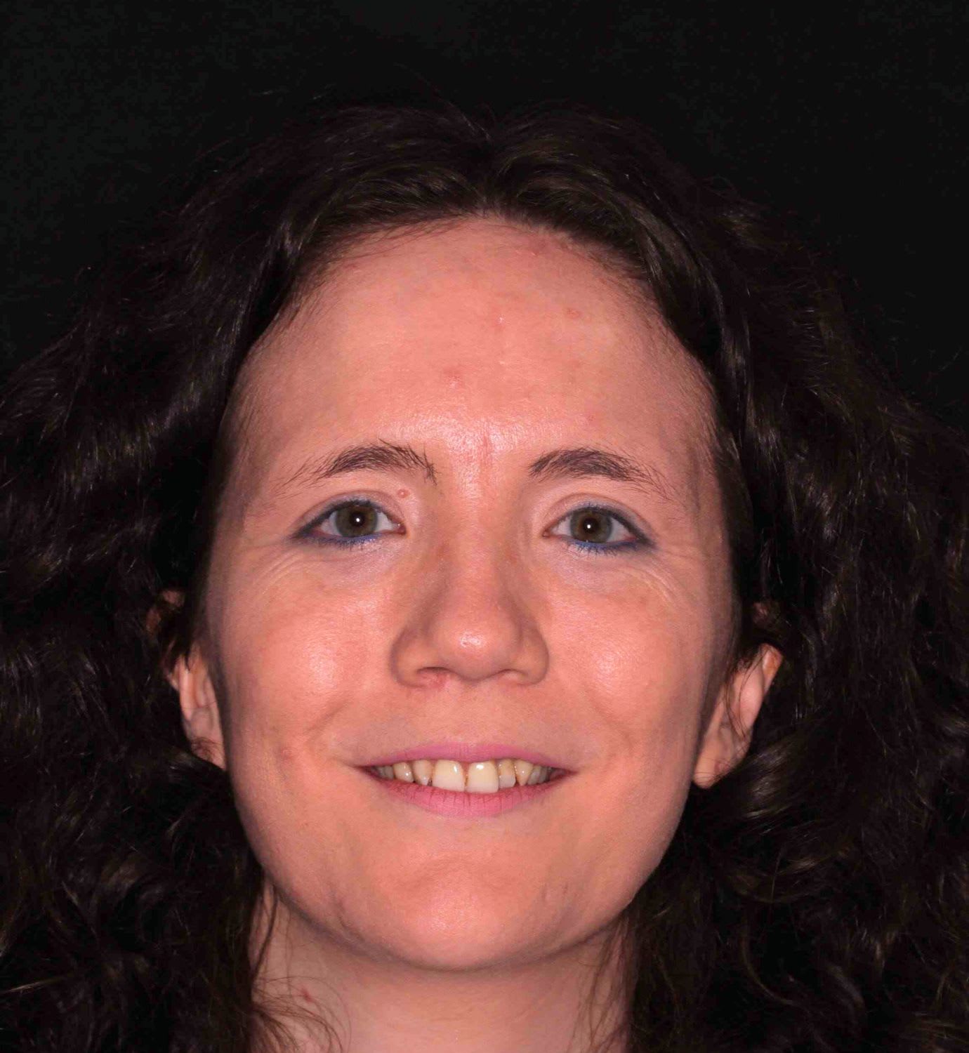 fotografía de antes