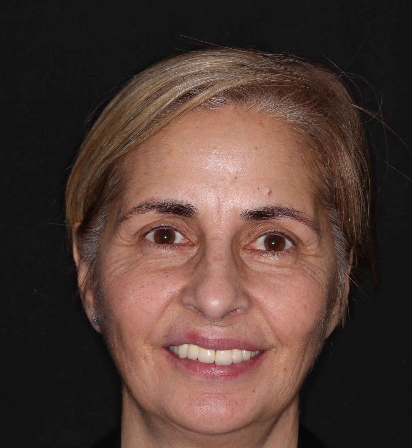 fotografía de antes