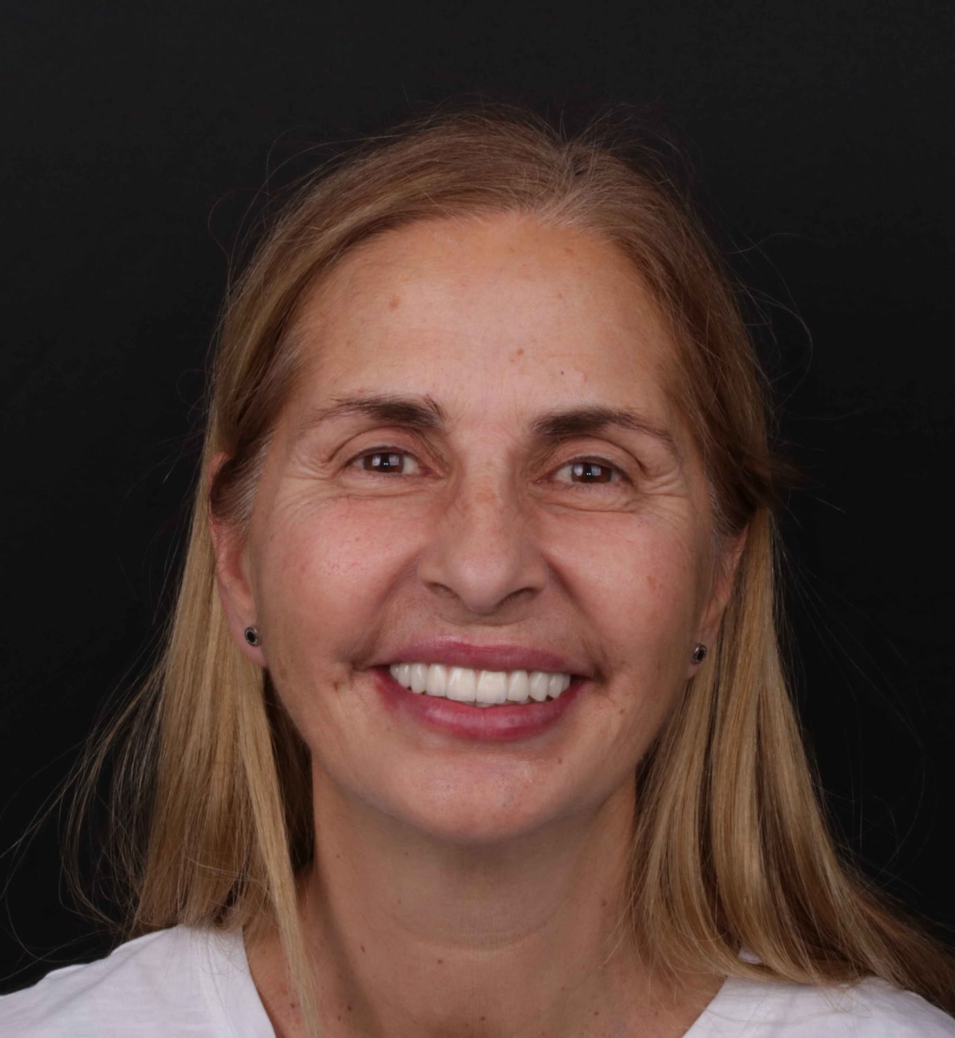 fotografía de después