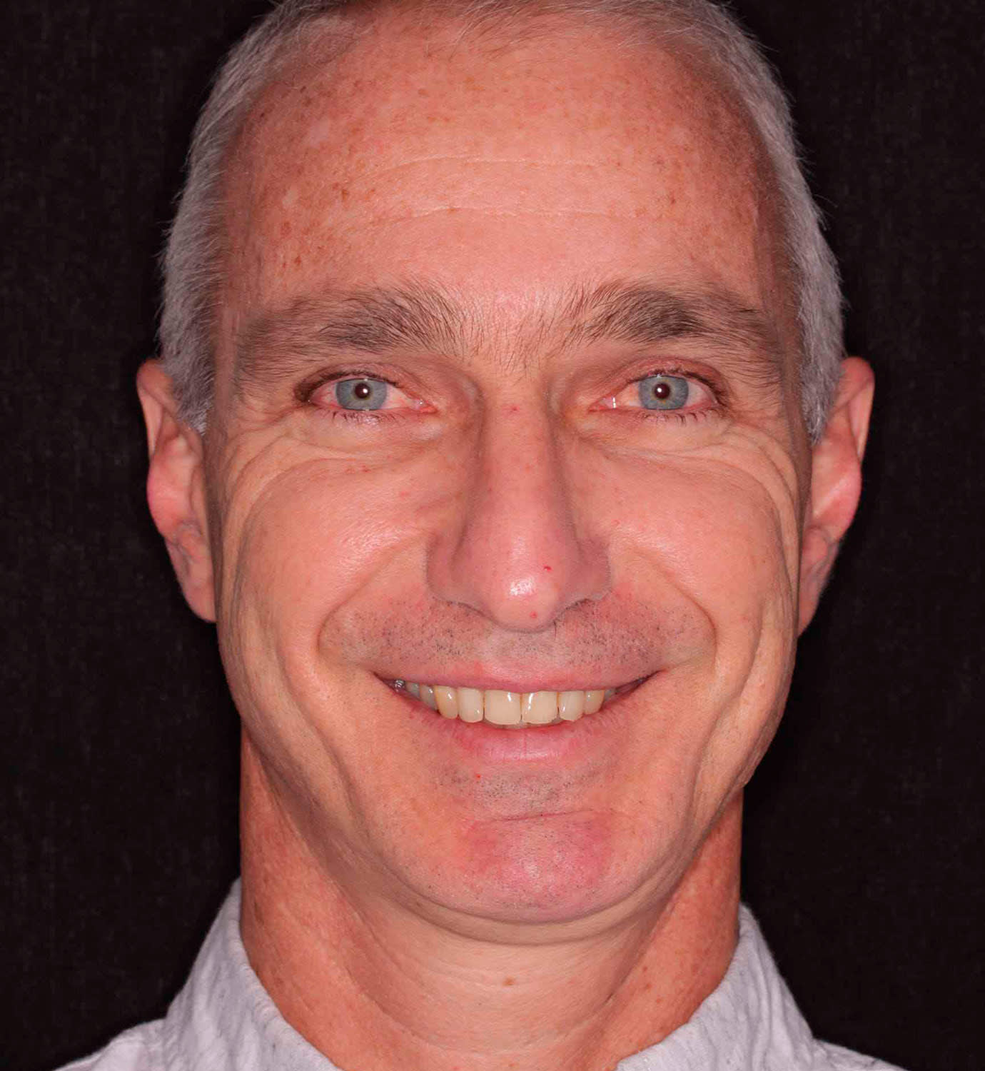 fotografía de antes