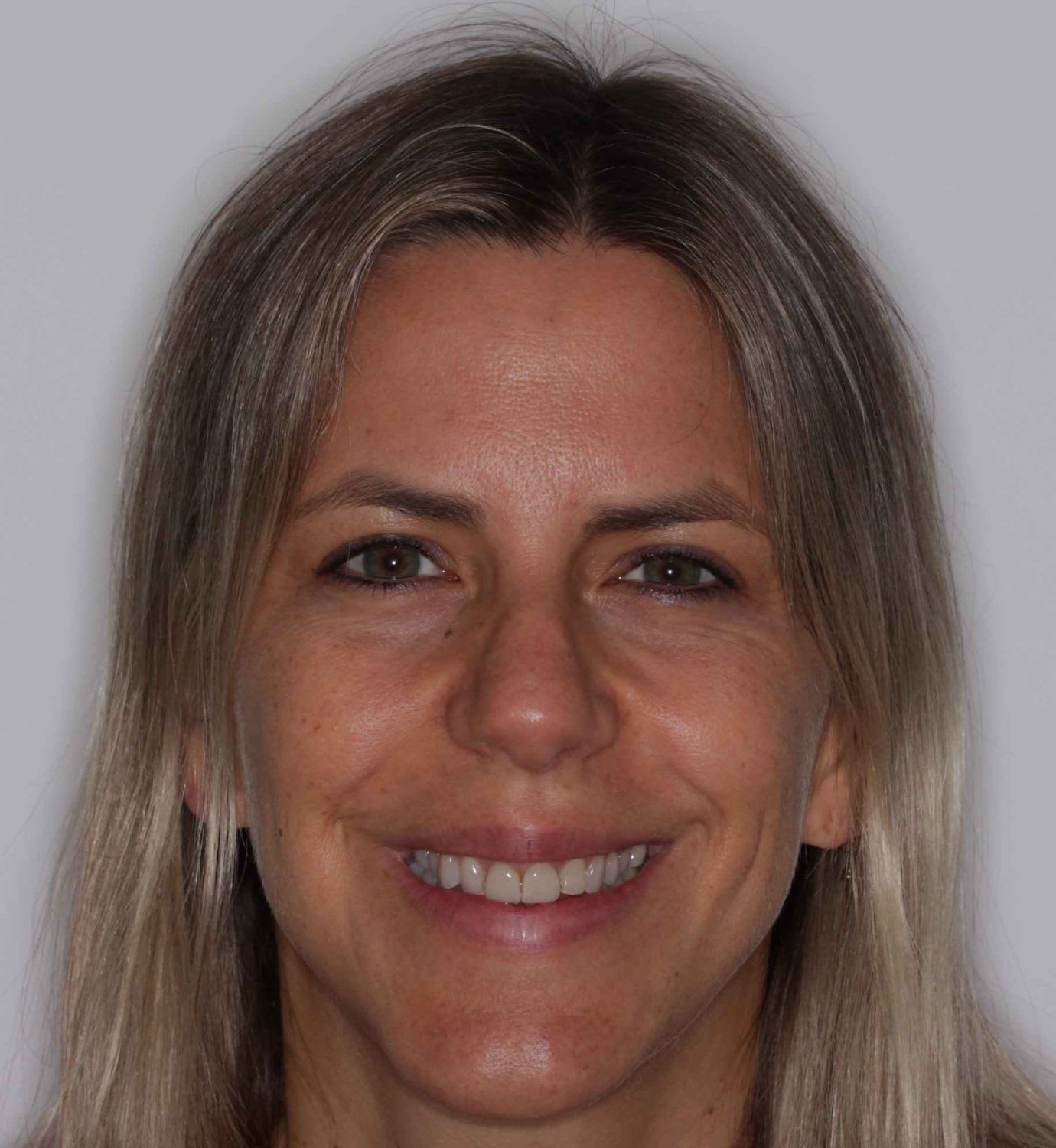 fotografía de antes