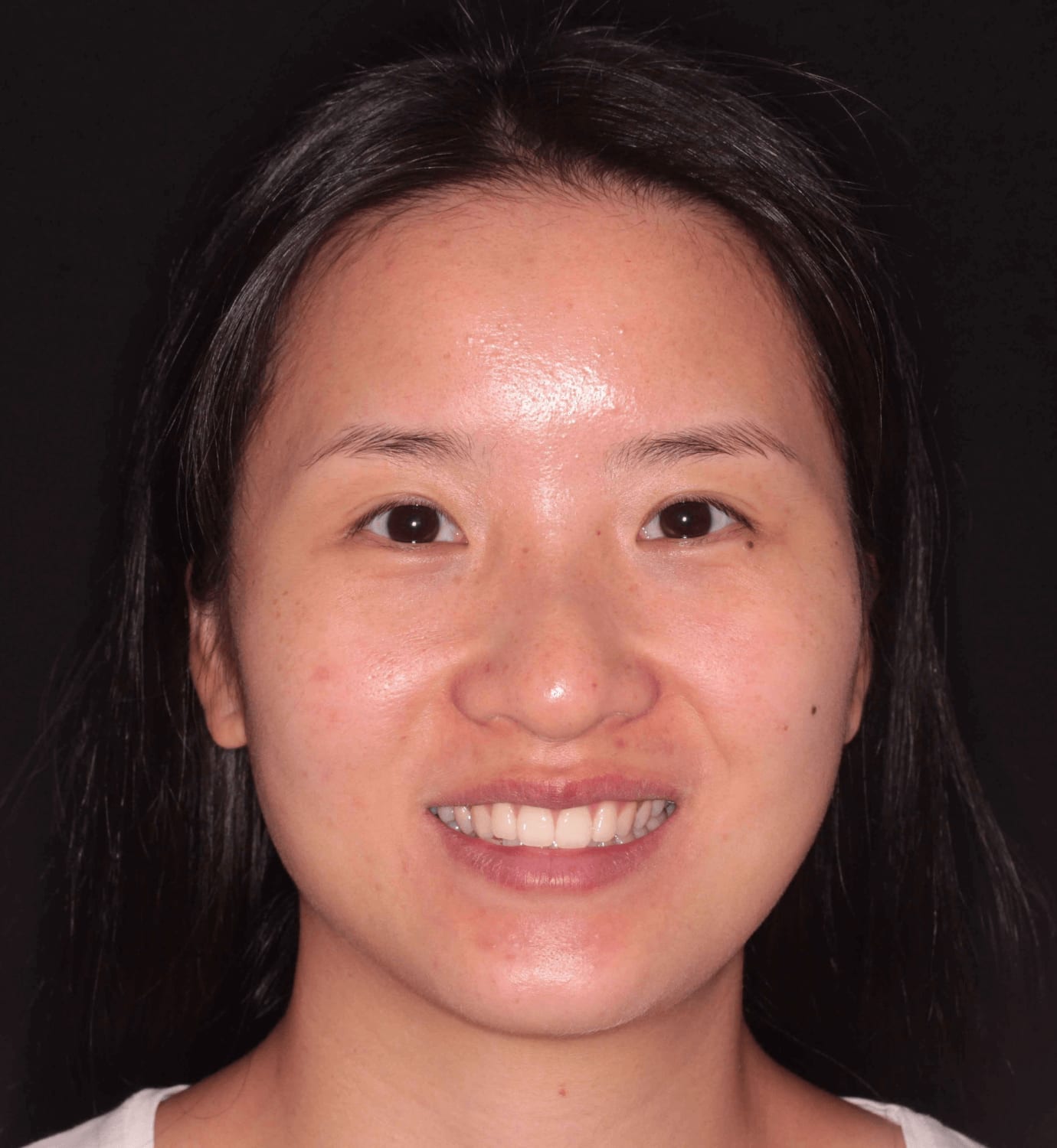 fotografía de antes