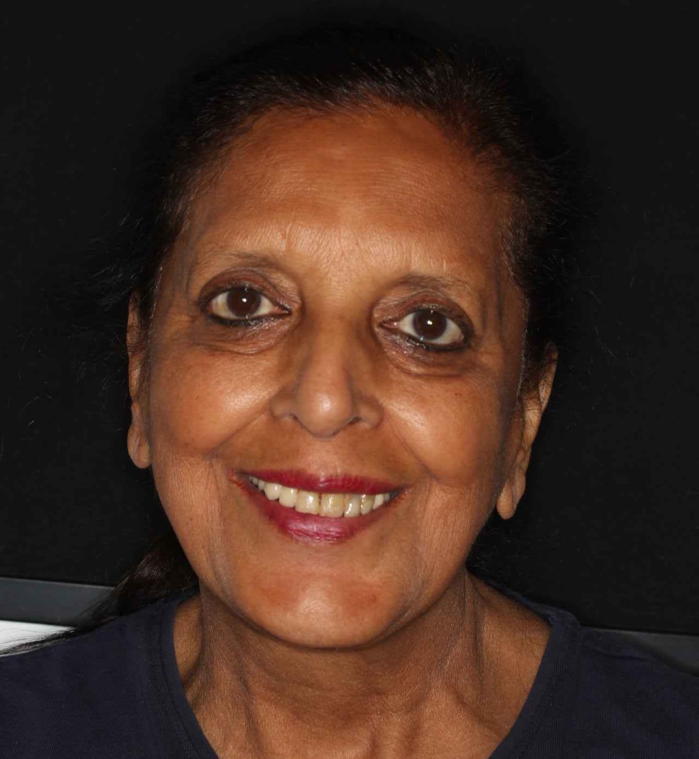 fotografía de antes