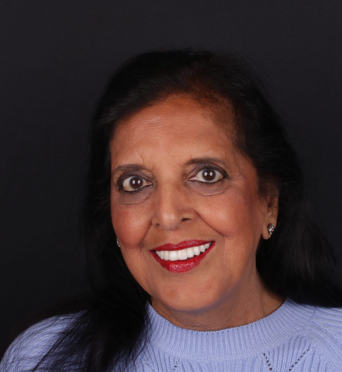 fotografía de después