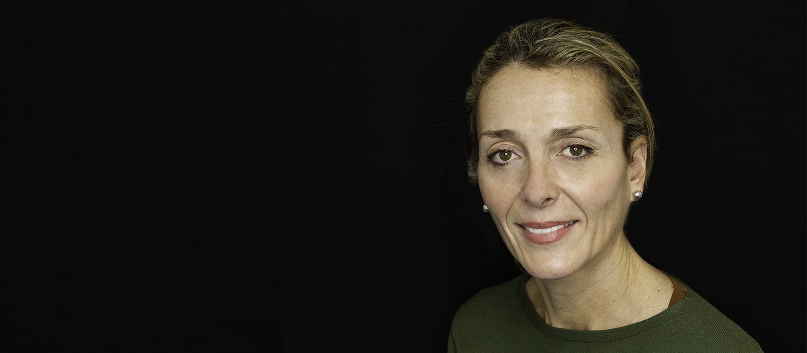 Experiencia de tratamiento estético en carillas dentales