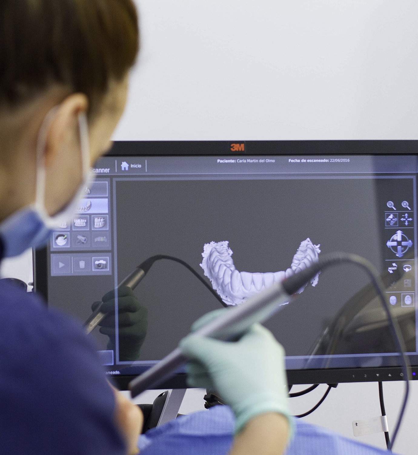 Escáner intraoral en 3D para ortodoncia e implantes