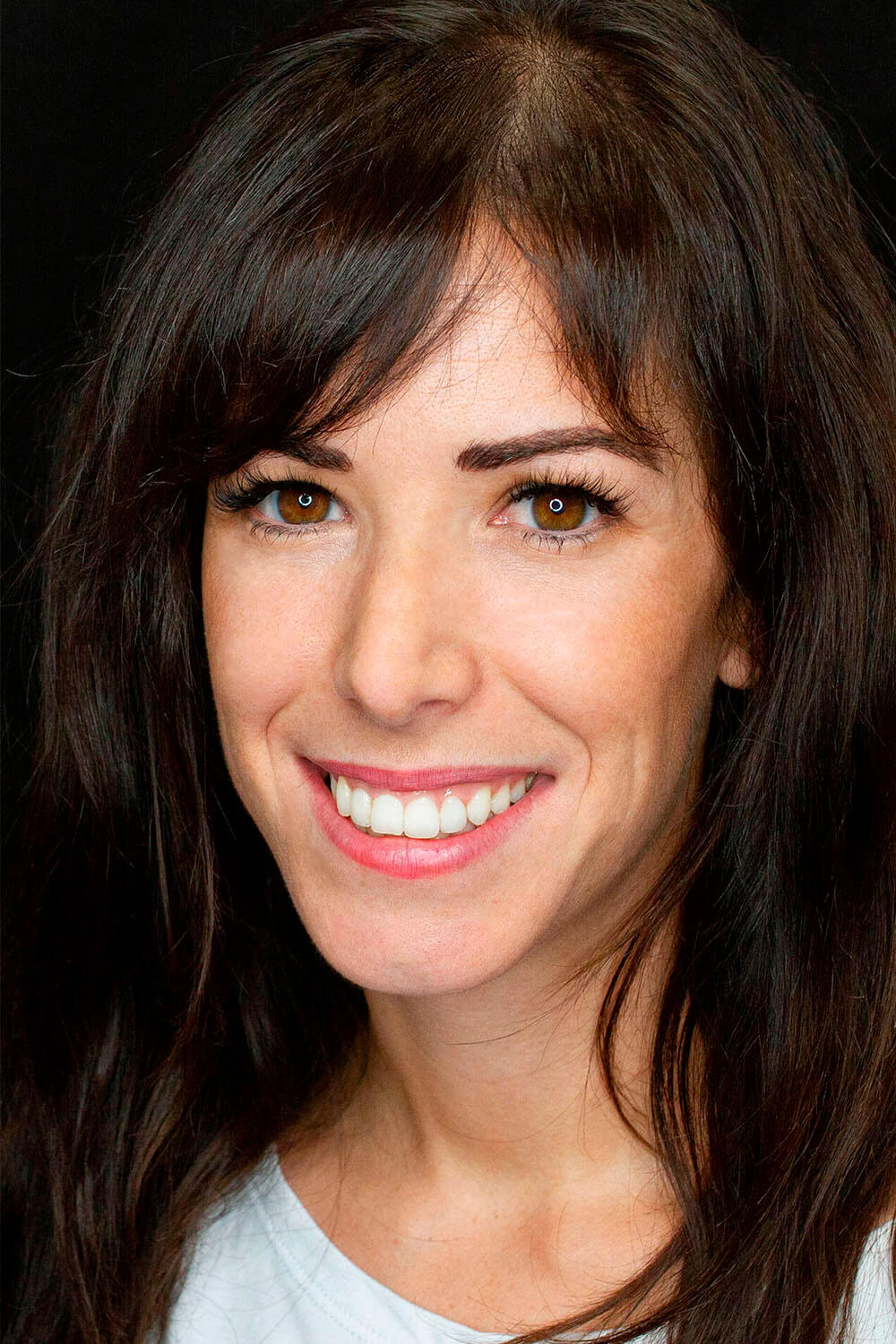 Caso de colocación de carillas dentales