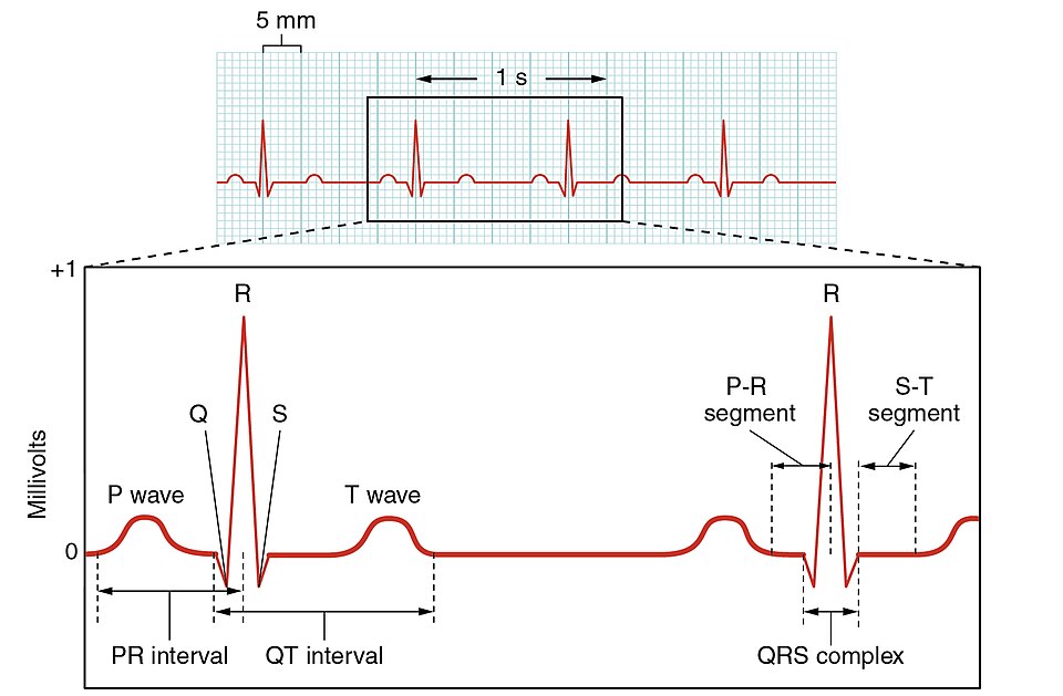 An electrocardiogram trace illustrating heart activity.