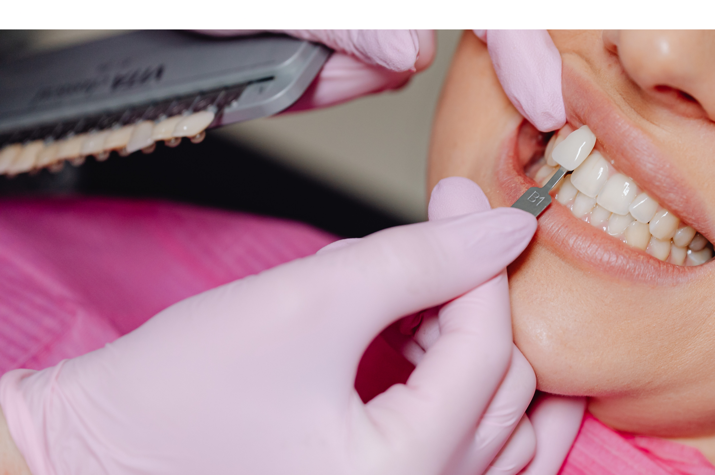 Cosmetic Dentistry & Whitening