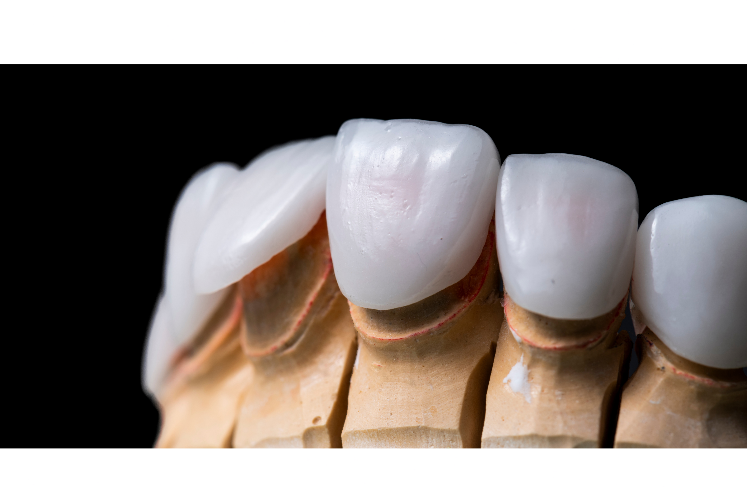 Cosmetic Dentistry & Whitening