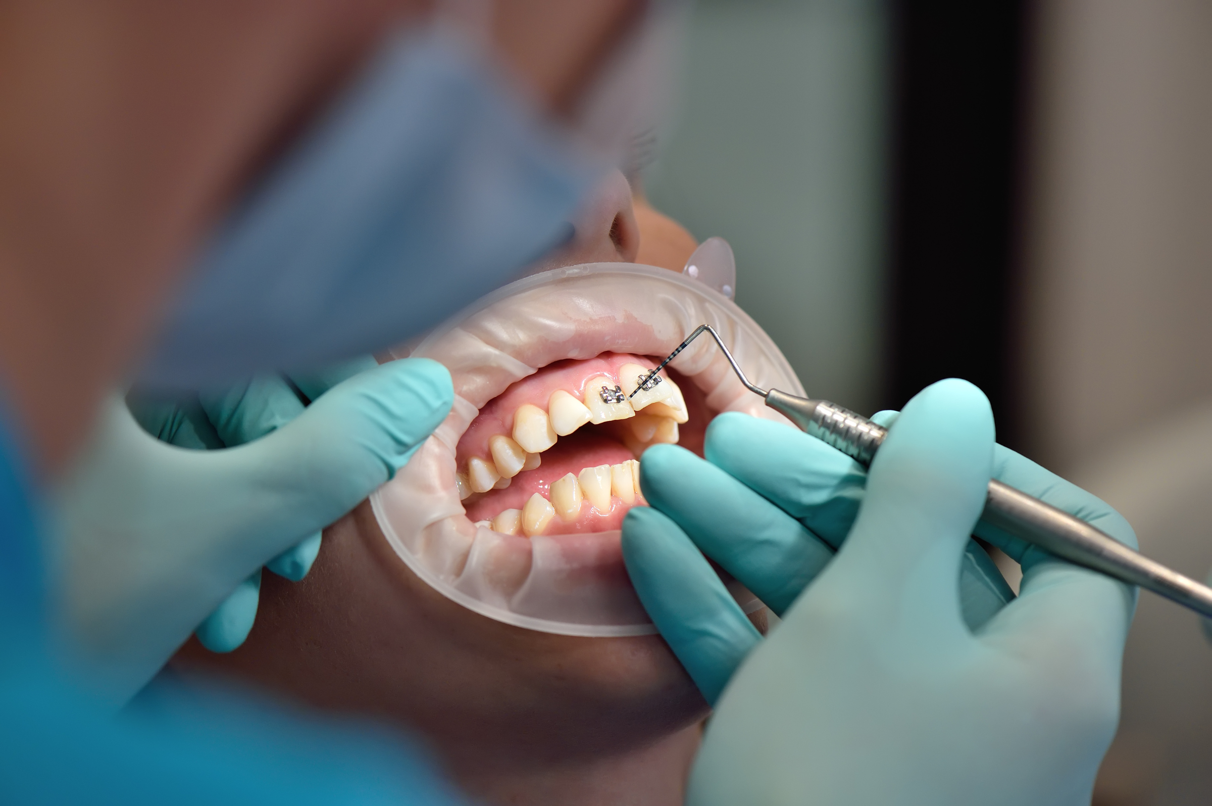 Orthodontics