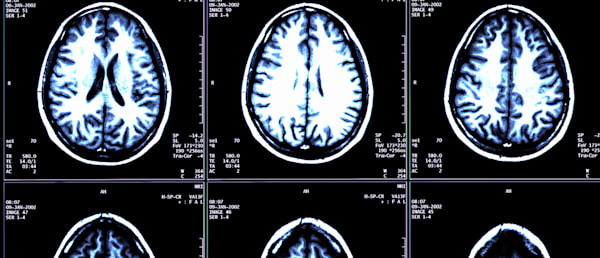 Medical Negligence Cases Examples Of Clinical Negligence Payouts Fieldfisher