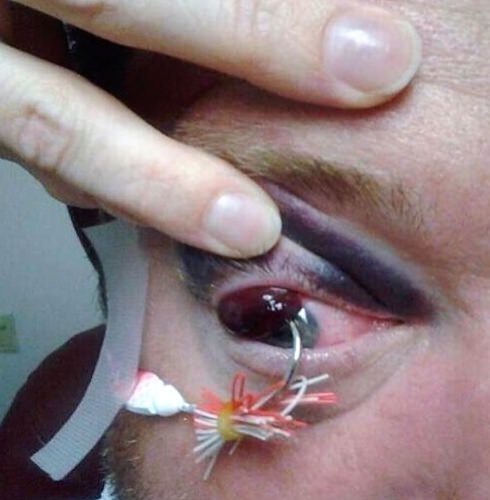 Caption This!
#YoullHookYourEyeOut #NoAprilFools #Fishing