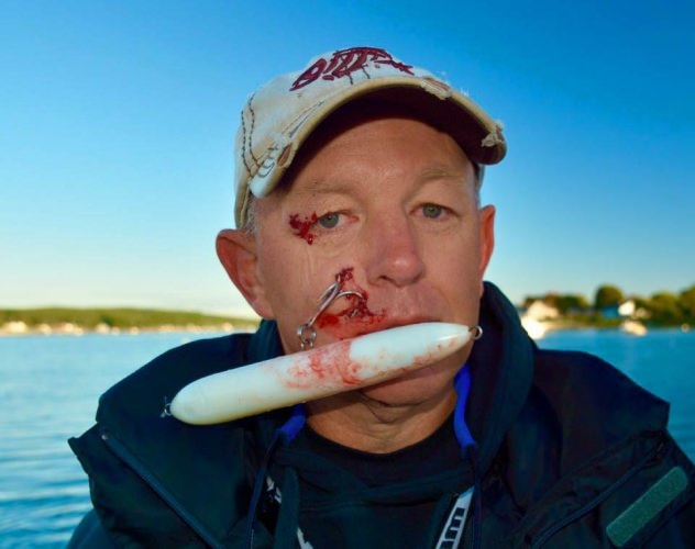 Ouch! Have you ever been "hooked"? #Fishing #FinandField #Adventure