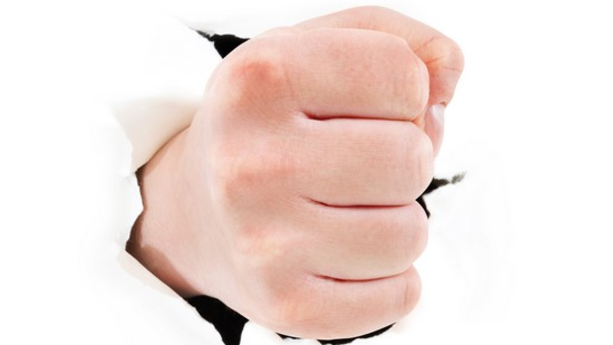 Naapurien kärhämässä outo käänne - löi itseään naamaan
