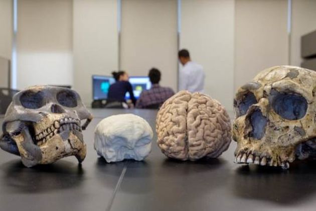 Brain size Brain size