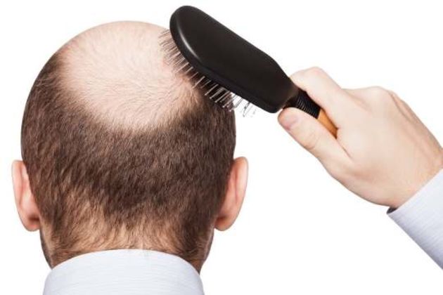 hair loss hair loss