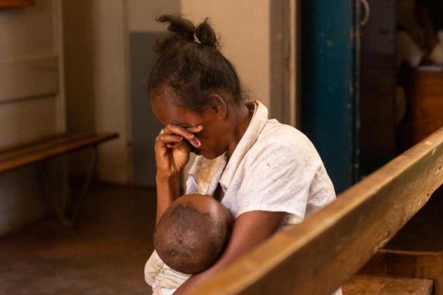 Measles Madagascar Measles Madagascar