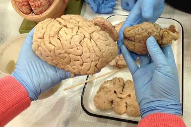 Mini brains Mini brains