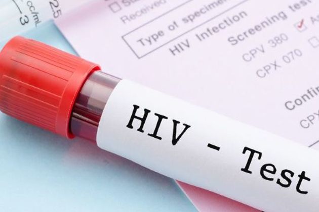 HIV-1 HIV-1