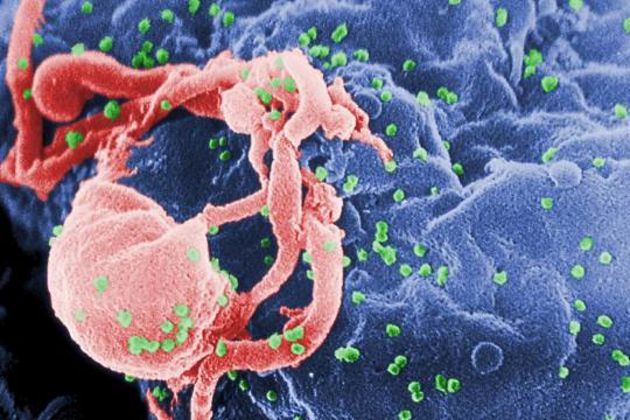 HIV HIV