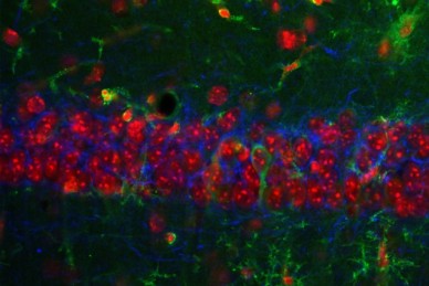 PV-DAPI-Cre-CA1-40x-1