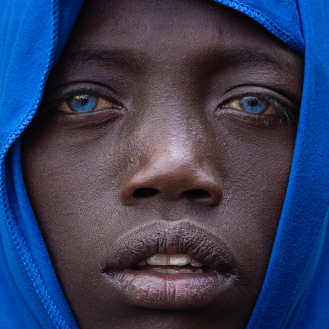 "The blue-eyed Ethiopian" stock image