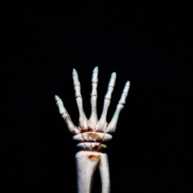 "Close up of right hand and lower arm skeleton against a dark background" stock image