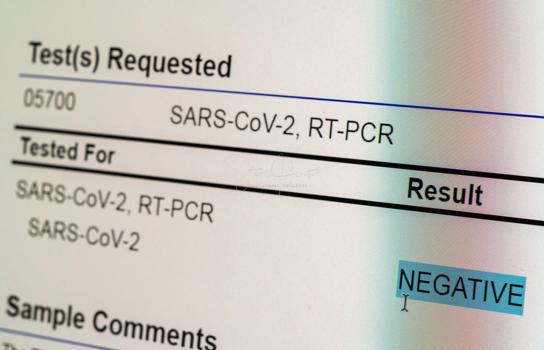 "View of computer screen showing result of PCR test for Covid-19 as negative" stock image