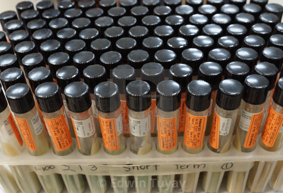 "Sputum Samples" by Edwin Tuyay - $37.35 "Sputum Samples" stock image
