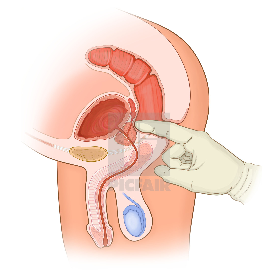 Rectal Exam Of A Normal Male In Cross Section Anatomy License