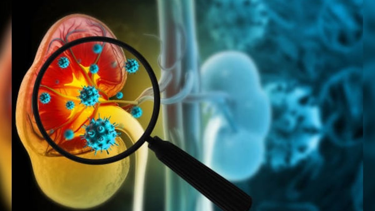 Karnataka sees kidney death toll surge to record high - kidney death toll