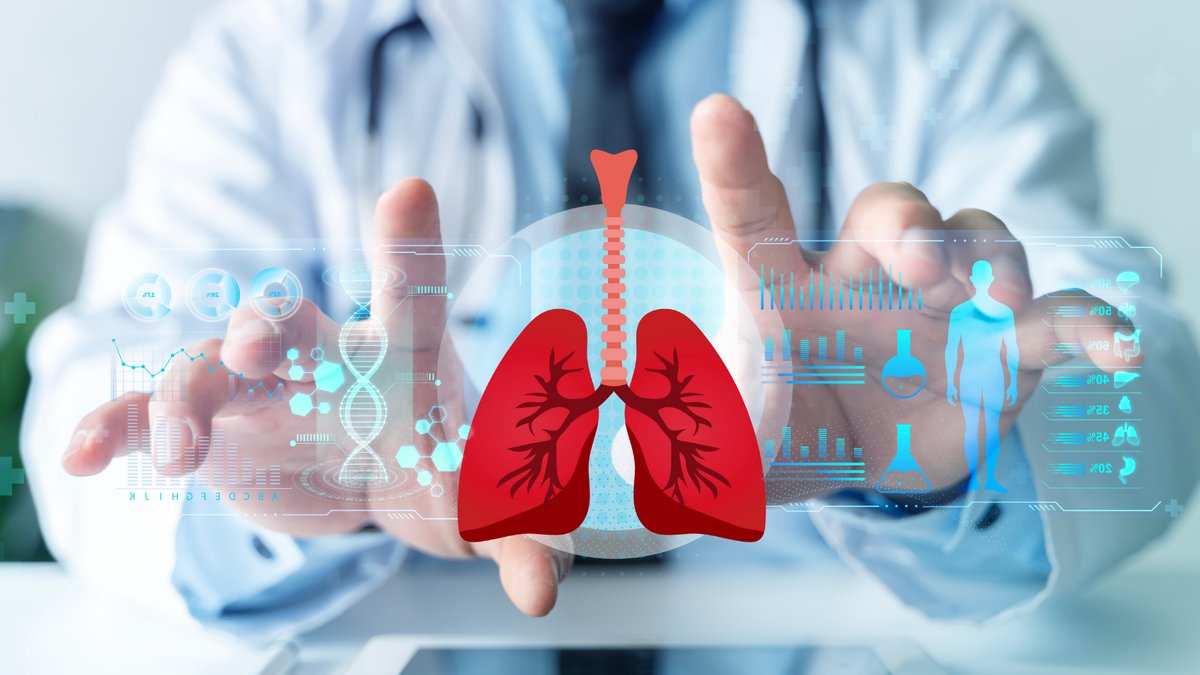 AI helps doctors with cancer care questions - cancer care