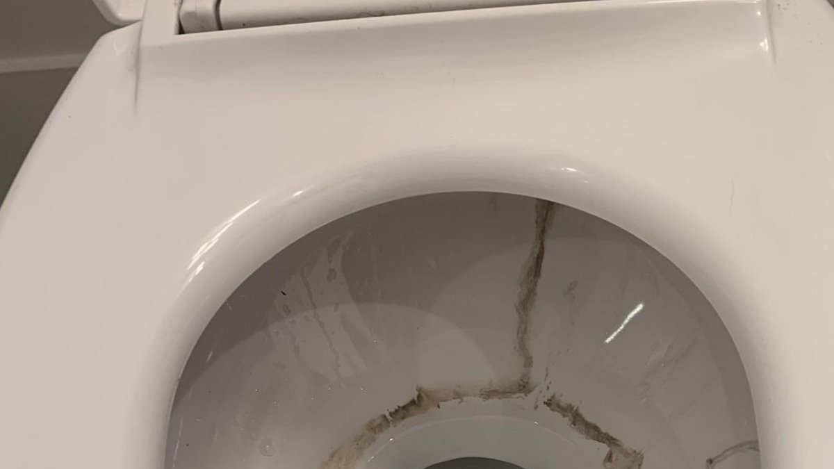 Citric Acid Emerges as Toilet Stain Remedy