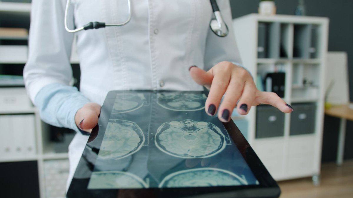 Doctor reviewing digital brain scans on a tablet in a medical office setting.