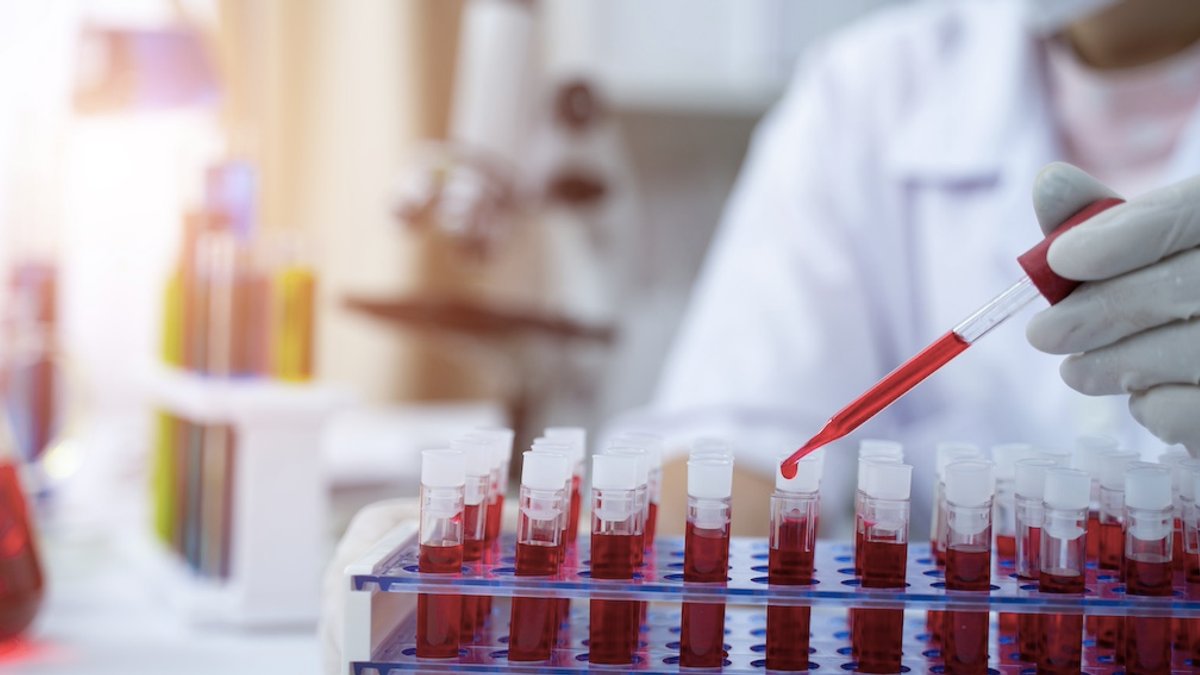 Astrin, OpenLoop Launch Nationwide Telehealth Breast Cancer Blood Test Astrin, OpenLoop Launch Nationwide Telehealth Breast Cancer Blood Test - telehealth breast cancer