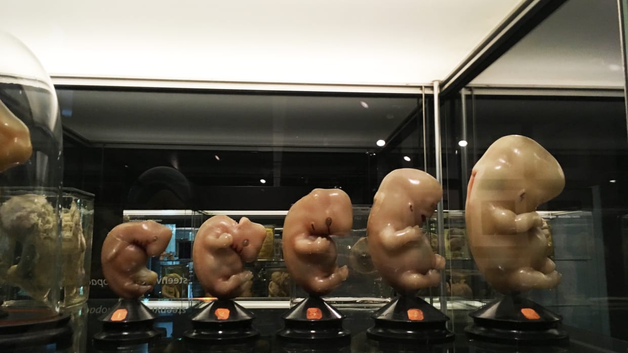 UvA buildings | Museum Vrolik: From tiger cubs to slices of brain