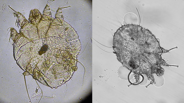 Schurft onder een microscoop