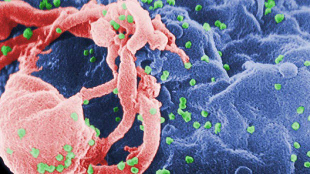 AMC-onderzoekers zetten belangrijke stap richting aidsvaccin
