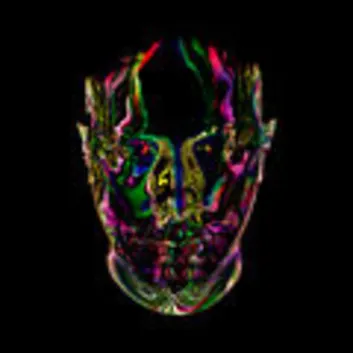 How Much is the Song Black Dyce by Eric Prydz Worth? Royalty & Value Breakdown
