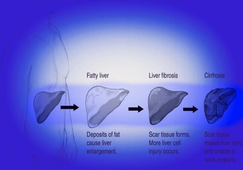 Fatty Acids vs crown Fried Chicken