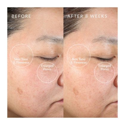 Custom PMD Beauty Clean Face Cleansing Brush Custom PMD Beauty Clean Face Cleansing Brush