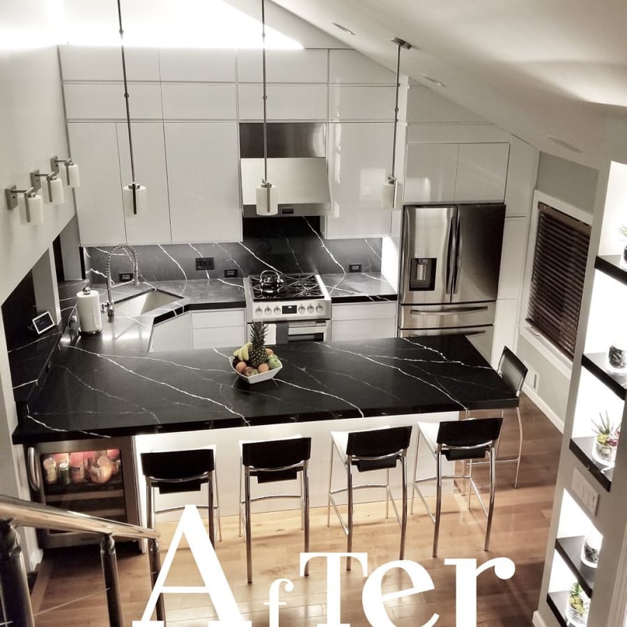 Before & after gallery in Hackensack, NJ