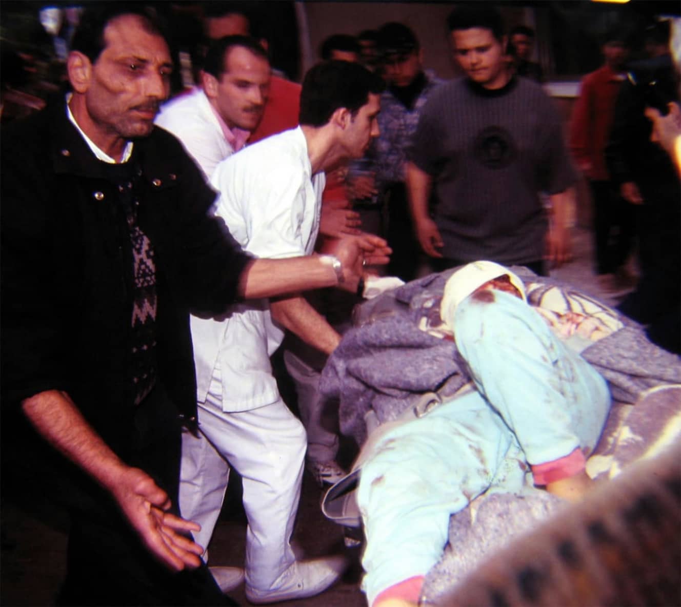 1996年４月、イスラエル軍の誤射によって、国連軍基地に避難していた住民106人が殺害された。写真は負傷した住民。筆者はこのとき現地で取材をしていた　撮影：黒井文太郎