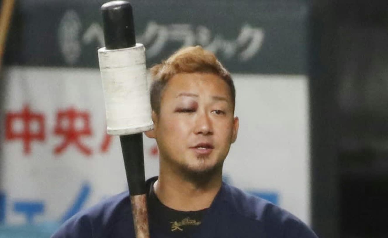 今年4月に右目を負傷した中田。具体的な原因はわかっていない。今季はトラブル続きだ(画像:共同通信社)